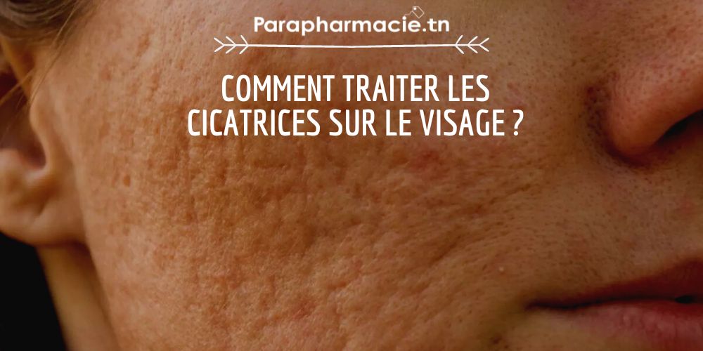 Comment traiter les cicatrices sur le visage ? | Parapharmacie.tn